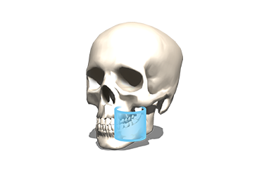 FOV Φ5 × H5cm FOV Φ5 × H5cm
