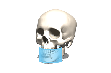FOV Φ9 × H6cm FOV Φ9 × H6cm